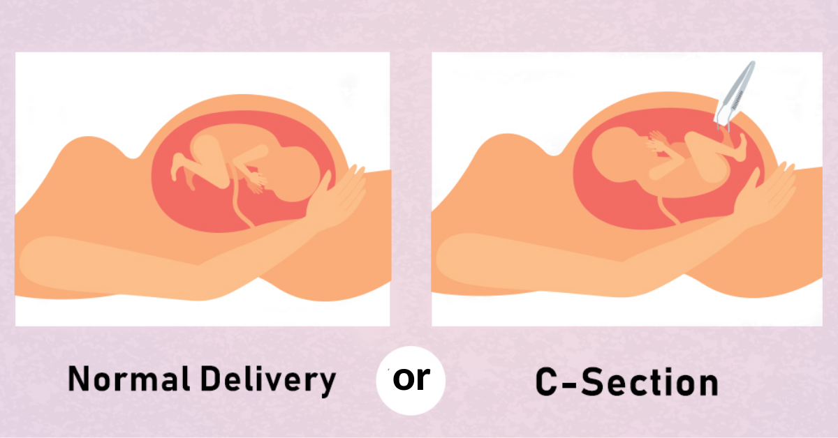 PCOD treatment in Ghansoli